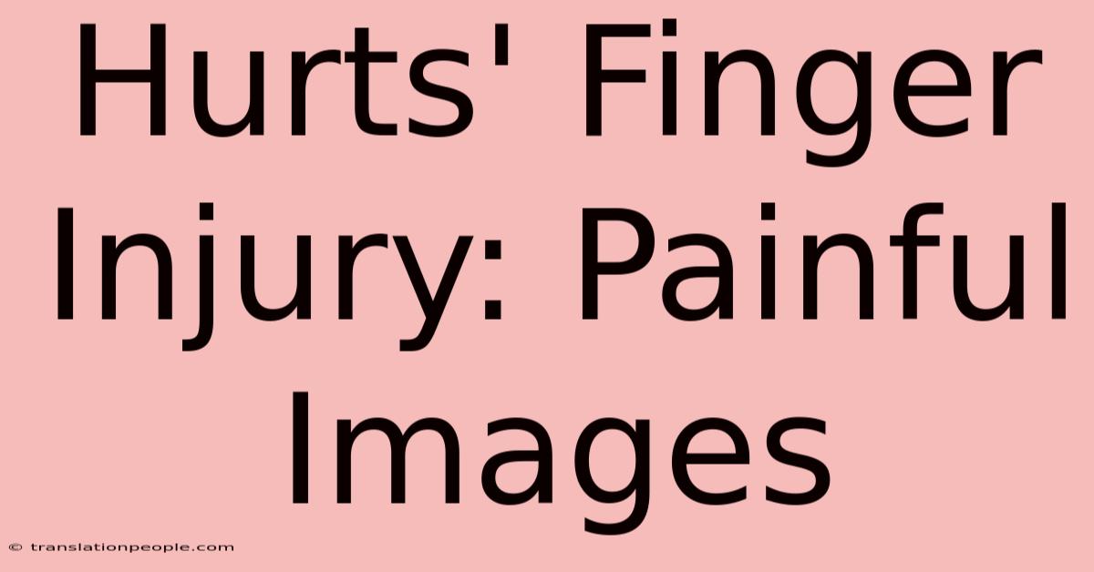 Hurts' Finger Injury: Painful Images